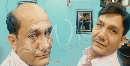 Hair Fixing Service in Sheikh Sarai